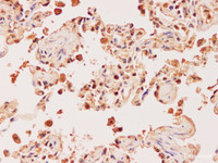 Immunohistochemistry of paraffin-embedded Human lung using EDN1 Polyclonal Antibody at dilution of 1:200