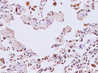 Immunohistochemistry of paraffin-embedded Human lung using TGFBI Polyclonal Antibody at dilution of 1:200