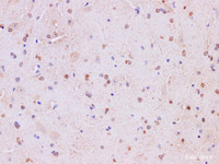 Immunohistochemistry of paraffin-embedded Mouse brain using Mark4 Polyclonal Antibody at dilution of 1:200