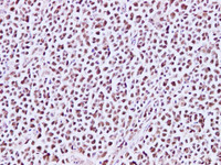 Immunohistochemistry of paraffin-embedded Human lymph node using MCM3 Polyclonal Antibody at dilution of 1:200