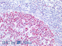 Immunohistochemistry of paraffin-embedded Human tonsil using MCM3 Polyclonal Antibody at dilution of 1:200 (Elabscience® Product Detected by Lifespan) .