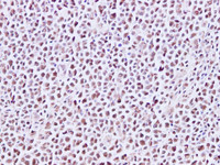 Immunohistochemistry of paraffin-embedded Human lymph node using CDC46 Polyclonal Antibody at dilution of 1:200