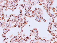 Immunohistochemistry of paraffin-embedded Human lung using CNTF Polyclonal Antibody at dilution of 1:200