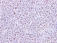 Immunohistochemistry of paraffin-embedded Human lymph node using MEF-2C Polyclonal Antibody at dilution of 1:200