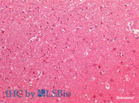 Immunohistochemistry of paraffin-embedded Human cerebral cortex using NEDD8 Polyclonal Antibody at dilution of 1:200 (Elabscience® Product Detected by Lifespan) .