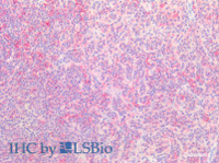 Immunohistochemistry of paraffin-embedded Human spleen using SNAP23 Polyclonal Antibody at dilution of 1:200 (Elabscience® Product Detected by Lifespan) .