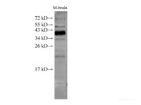 Western Blot analysis of Mouse brain tissue using ATXN3 Polyclonal Antibody at dilution of 1:500