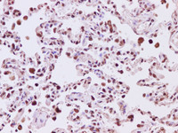 Immunohistochemistry of paraffin-embedded Human lung tissue using ATXN3 Polyclonal Antibody at dilution of 1:200