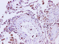 Immunohistochemistry of paraffin-embedded Human lung using ANXA5 Polyclonal Antibody at dilution of 1:200