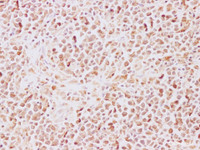 Immunohistochemistry of paraffin-embedded Human lymph node using TRAF5 Polyclonal Antibody at dilution of 1:200