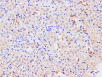 Immunohistochemistry of paraffin-embedded Mouse kidney using TRAF5 Polyclonal Antibody at dilution of 1:200
