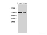 Western Blot analysis of Rat heart and Rat brain using Lamin B1 Polyclonal Antibody at dilution of 1:1000