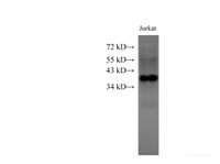 Western Blot analysis of Jurkat cells using HMG20B Polyclonal Antibody at dilution of 1:1000