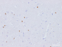 Immunohistochemistry of paraffin-embedded Rat brain using Fgf2 Polyclonal Antibody at dilution of 1:100