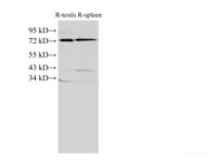 Western Blot analysis of Rat testis and Rat spleen using ANXA6 Polyclonal Antibody at dilution of 1:2000