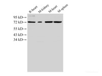 Western Blot analysis of Rat heart, Mouse kidney, Mouse heart and Mouse spleen using ANXA6 Polyclonal Antibody at dilution of 1:2000.