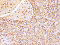 Immunohistochemistry of paraffin-embedded Human tonsil using Anxa6 Polyclonal Antibody at dilution of 1:100