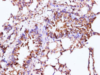 Immunohistochemistry of paraffin-embedded Mouse lung using IFITM3 Polyclonal Antibody at dilution of 1:100