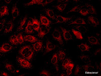 Immunofluorescence analysis of Hela cells using IFITM3 Polyclonal Antibody at dilution of 1:100