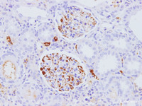 Immunohistochemistry of paraffin-embedded Rat kidney using Pdgfb Polyclonal Antibody at dilution of 1:100