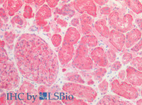 Immunohistochemistry of paraffin-embedded Human kidney using SPTAN1 Polyclonal Antibody at dilution of 1:100 (Elabscience® Product Detected by Lifespan) .