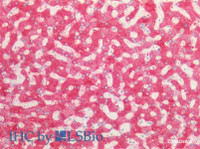 Immunohistochemistry of paraffin-embedded Human liver using PCK1 Polyclonal Antibody at dilution of 1:100 (Elabscience® Product Detected by Lifespan) .