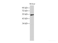 Western Blot analysis of Mouse liver using GCK Polyclonal Antibody at dilution of 1:1000