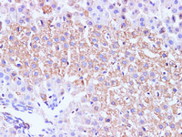 Immunohistochemistry of paraffin-embedded Mouse liver using GCK Polyclonal Antibody at dilution of 1:100