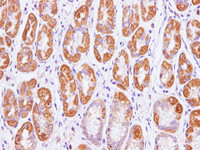 Immunohistochemistry of paraffin-embedded Human stomach using Cytochrome c1 Polyclonal Antibody at dilution of 1:100 (400×)