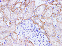 Immunohistochemistry of paraffin-embedded Mouse kidney using CCL2 Polyclonal Antibody at dilution of 1:100