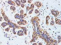 Immunohistochemistry of paraffin-embedded Human breast using CCL2 Polyclonal Antibody at dilution of 1:200