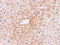 Immunohistochemistry of paraffin-embedded Mouse liver using IL2 Polyclonal Antibody at dilution of 1:100