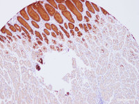 Immunohistochemistry of paraffin-embedded Human stomach using MUC5AC Polyclonal Antibody at dilution of 1:100 (100×)