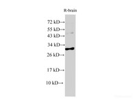 Western Blot analysis of Rat brain using CRP Polyclonal Antibody at dilution of 1:1000