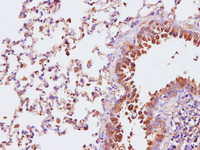 Immunohistochemistry of paraffin-embedded Rat lung using CRP Polyclonal Antibody at dilution of 1:100