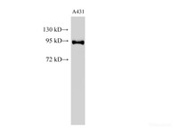 Western Blot analysis of A431 cells using POSTN Polyclonal Antibody at dilution of 1:500