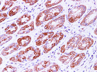 Immunohistochemistry of paraffin-embedded Human stomach using IHH Polyclonal Antibody at dilution of 1:100 (400×)
