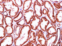 Immunohistochemistry of paraffin-embedded Human kidney using IHH Polyclonal Antibody at dilution of 1:100 (400×)