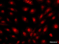 Immunofluorescence analysis of U-2OS cells using BRCA1 Polyclonal Antibody at dilution of 1:100