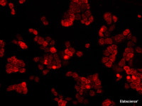 Immunofluorescence analysis of A431 cells using EGFR Polyclonal Antibody at dilution of 1:100