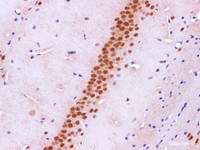 Immunohistochemistry of paraffin-embedded Mouse hippocampus using PTEN Polyclonal Antibody at dilution of 1:100