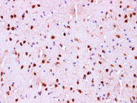 Immunohistochemistry of paraffin-embedded Mouse brain using PTEN Polyclonal Antibody at dilution of 1:100