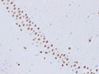 Immunohistochemistry of paraffin-embedded Rat hippocampus using PTEN Polyclonal Antibody at dilution of 1:100