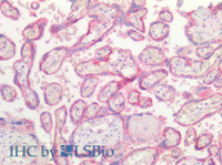 Immunohistochemistry of paraffin-embedded Human Placenta using E-Cadherin Polyclonal Antibody at dilution of 1:100 (Elabscience® Product Detected by Lifespan) .