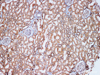 Immunohistochemistry of paraffin-embedded Human kidney using GSTM1 Polyclonal Antibody at dilution of 1:100