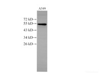 Western Blot analysis of A549 cells using CK-7 Polyclonal Antibody at dilution of 1:2000