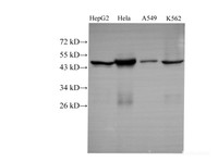 Western Blot analysis of HepG2, Hela, A549 and k562 using CK-18 Polyclonal Antibody at dilution of 1:1000