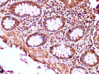 Immunohistochemistry of paraffin-embedded Human colon using NFATC4 Polyclonal Antibody at dilution of 1:100