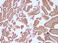 Immunohistochemistry of paraffin-embedded Human duodenum using NRAS Polyclonal Antibody at dilution of 1:100 (100×)