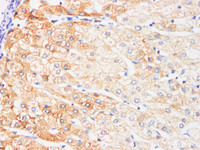 Immunohistochemistry of paraffin-embedded Human liver using IFNAR1 Polyclonl Antibody at dilution of 1:200.